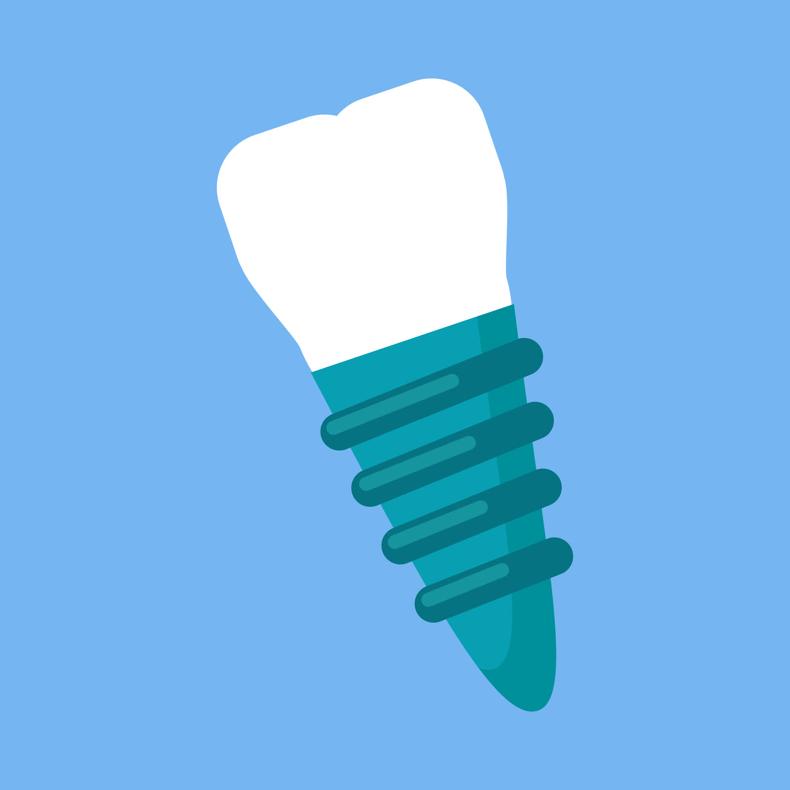 Dental implants treatment in Saginaw